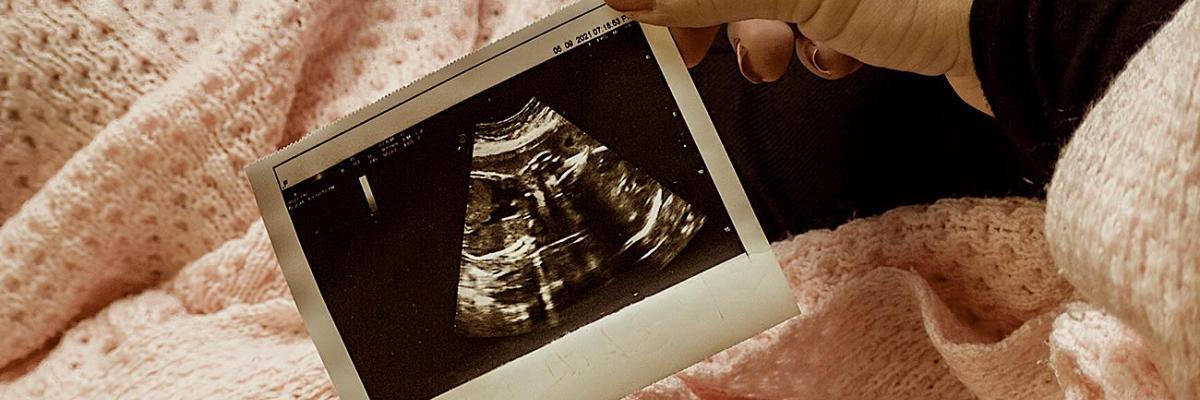 Mother holding scan of unborn child